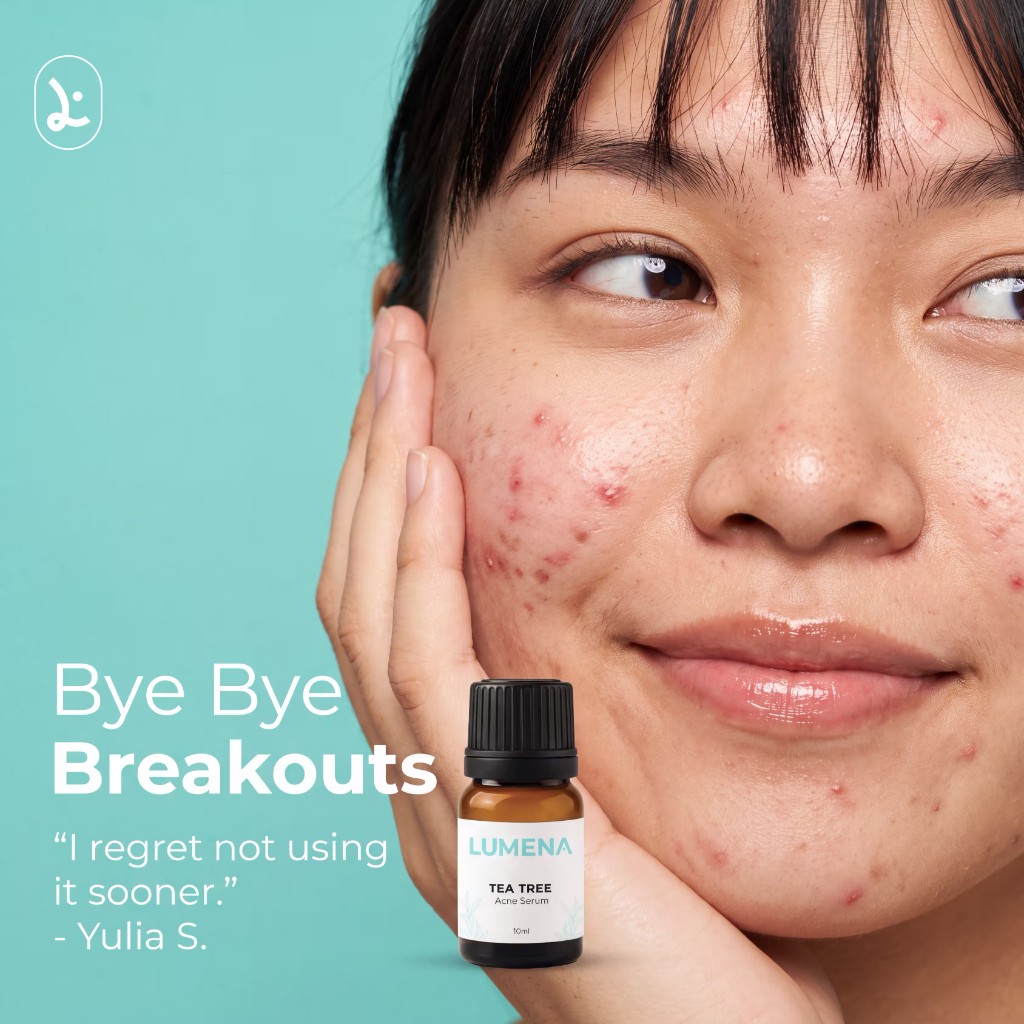 Bye Bye Breakouts — testimoni Yulia S. dengan Tea Tree Acne Serum